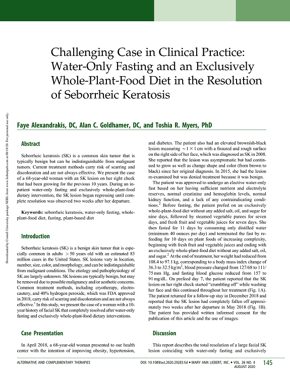 Challenging Case in Clinical Practice: Water-Only Fasting and an Exclusively Whole-Plant-Food Diet in the Resolution of Seborrheic Keratosis