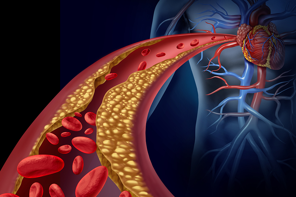 Cholesterol in the blood