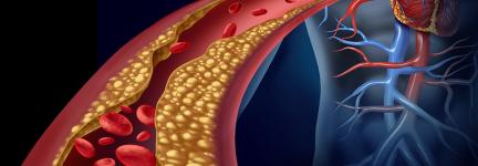 Cholesterol in the blood